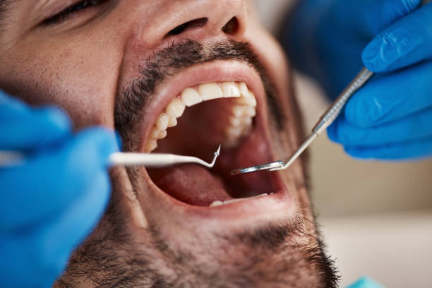 Best Emergency Broken Tooth Repair in St Augusta, MN